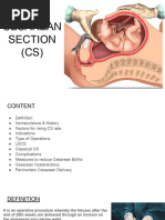 LSCS: Definition, Types, and Indications | PDF | Caesarean Section ...