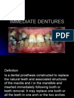 Immediate Dentures