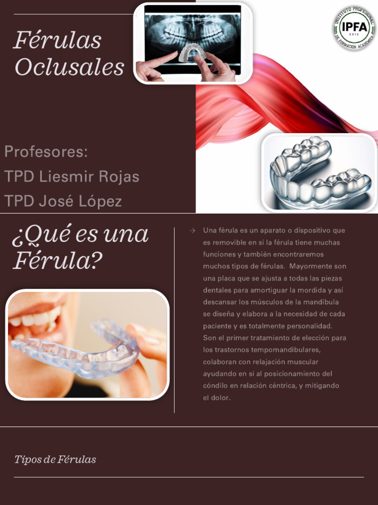 Tipos y Funciones de Férulas Dentales | PDF | Enfermedades y trastornos ...