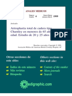Artroplastia Total de Cadera Tipo Charnley en Menores de 65 Años (D y P)