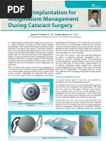 Download Pearls for Toric IOL Implantation During Cataract Surgery Dr Suresh K Pandey SuVi Eye Institute amp Lasik Laser Center Kota India by Dr Suresh K Pandey SN91687226 doc pdf