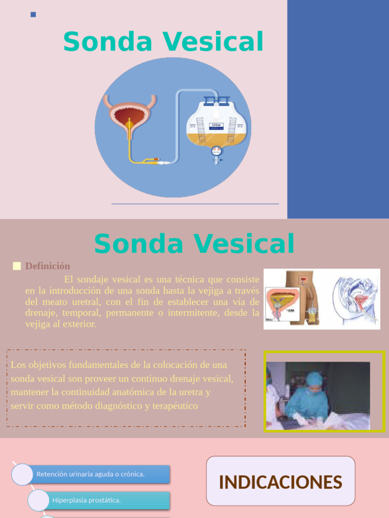 Sonda Vesical: Uso y Procedimiento | PDF | Labios | Urología