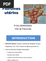 Classification FIGO Des Fibromes Utérins - Embolisation Fibrome Utérin ...