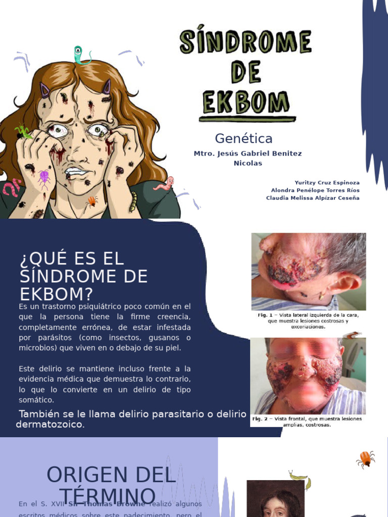 S ndrome De Ekbom Delirio Parasitario PDF Enga o Psicosis