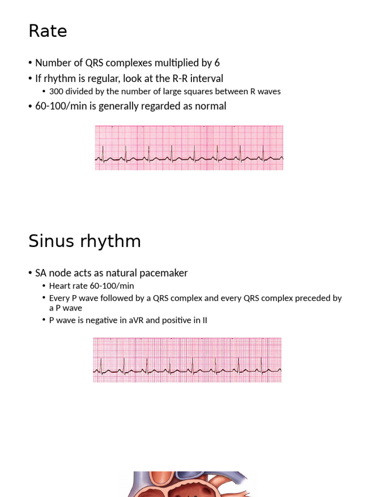 ECG Interpretation: Heart Rhythm & Axis | PDF | Electrocardiography ...