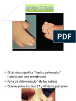 Sindactilia y Polidactilia