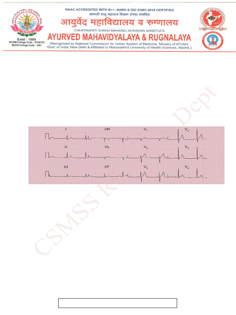 ECG Project Club File-Roll No-12 | PDF