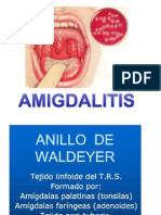 amigdalitis orl