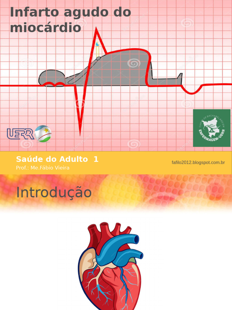 Infarto Agudo do Miocárdio: Causas e Tratamento | PDF | Infarto do ...