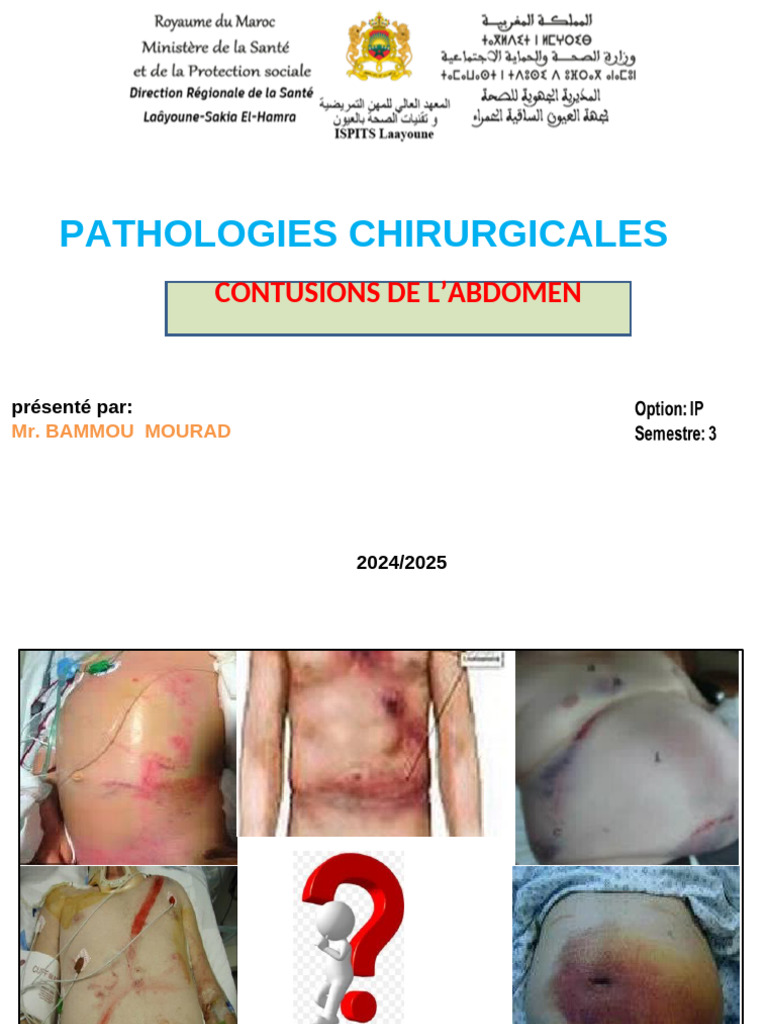 Contusions abdominales : mécanismes et soins | PDF | Saignement | Abdomen