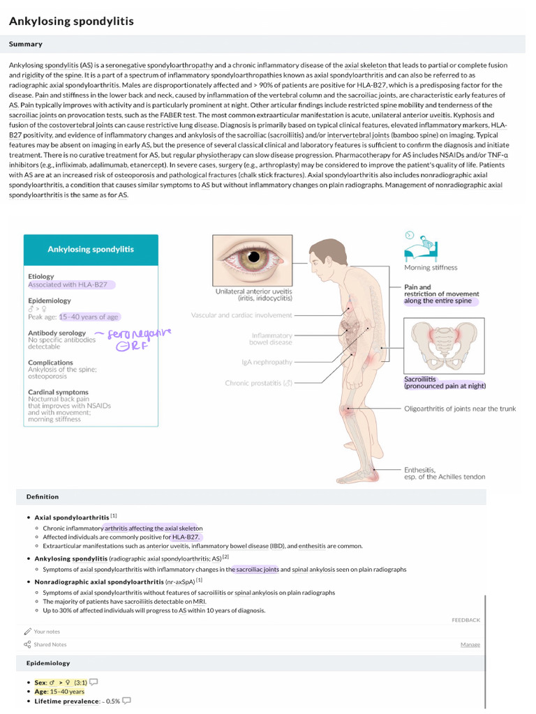 Ankolysing Spondylitis | PDF
