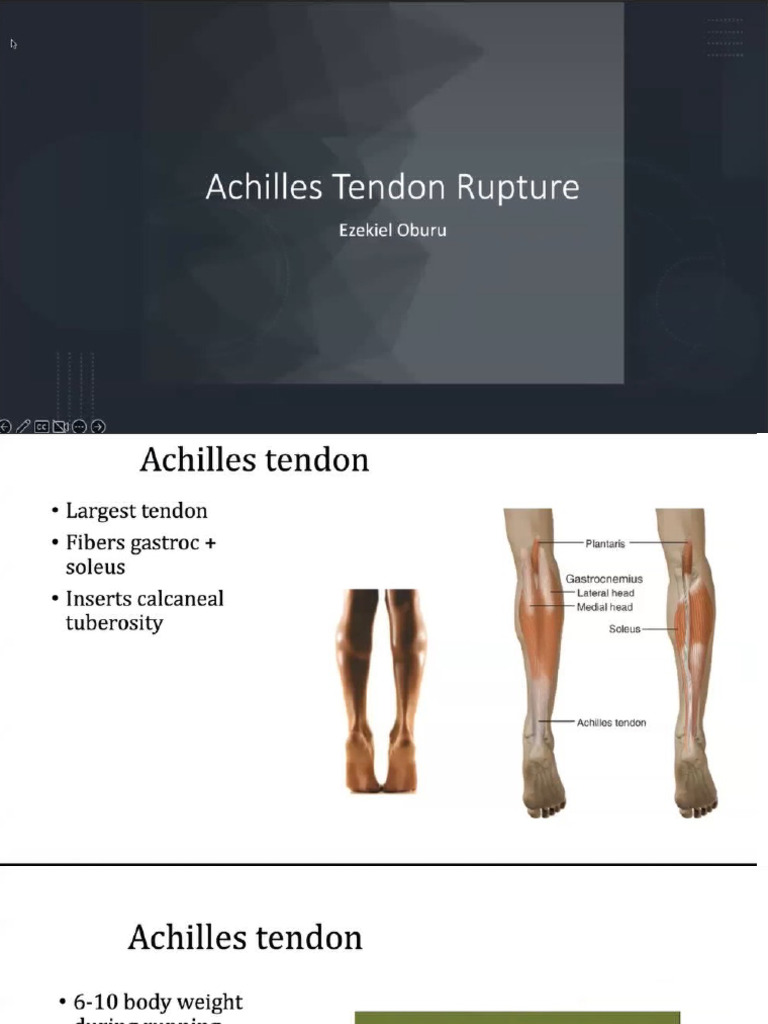 Ankle and Foot Injuries | PDF
