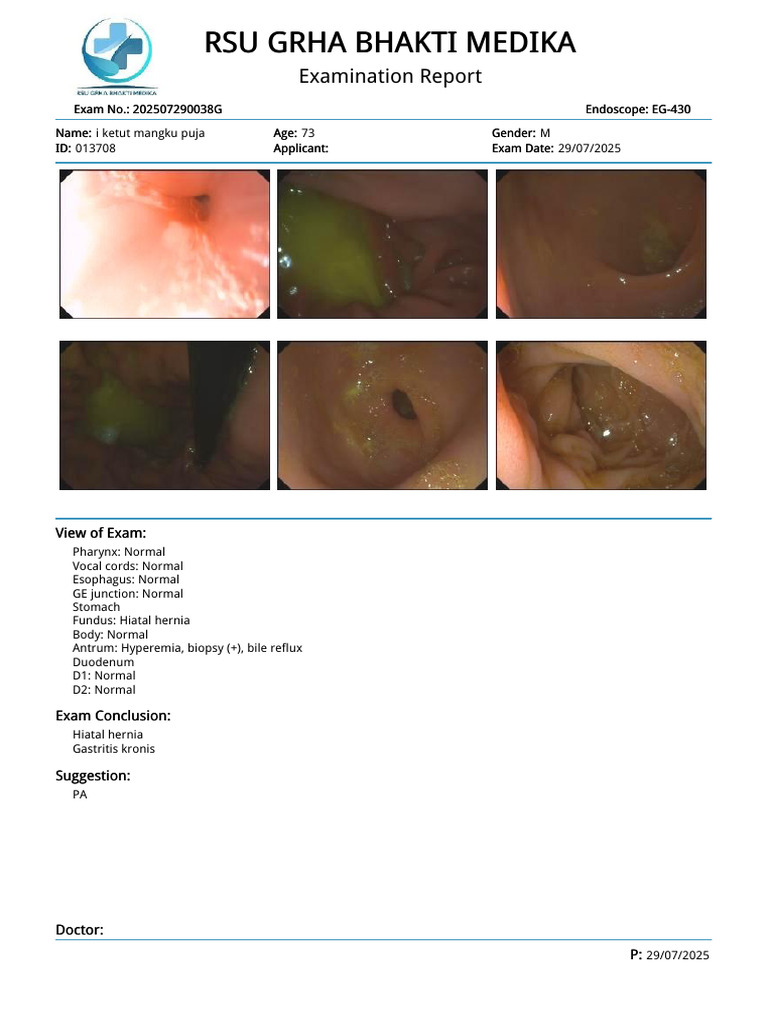 Endoscopy Report: Hiatal Hernia & Gastritis | PDF