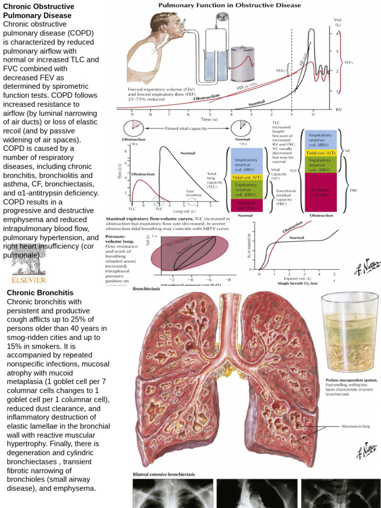 Overview of Chronic Lung Diseases | PDF | Chronic Obstructive Pulmonary ...