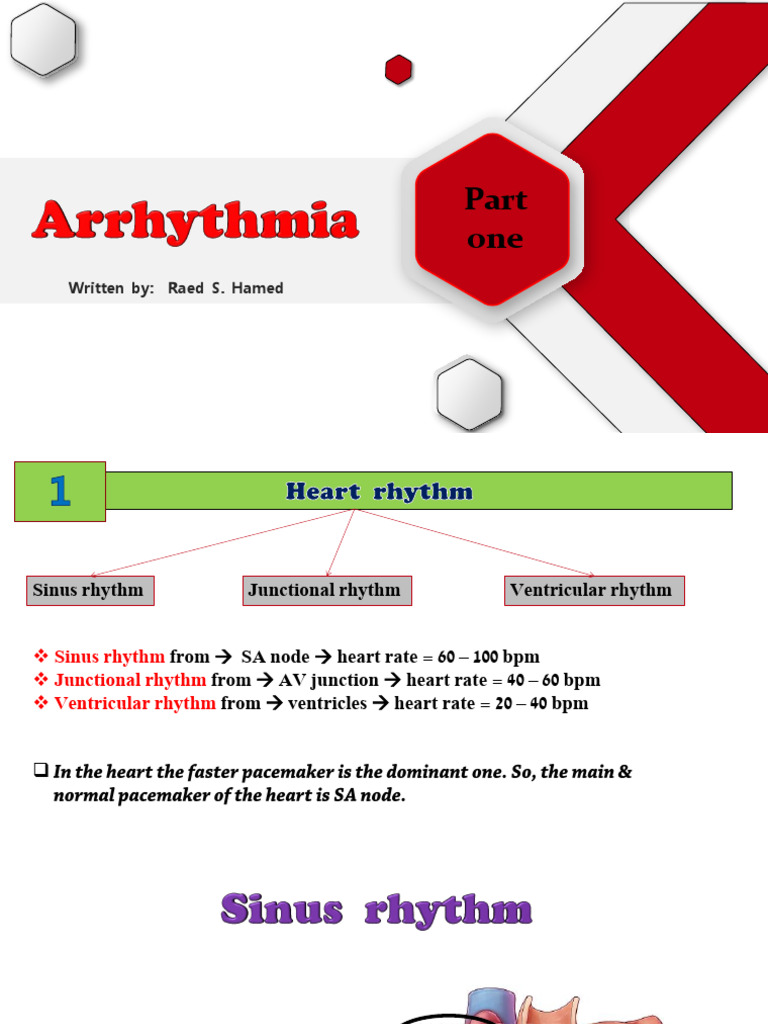 Arrhythmia Part 1 | PDF
