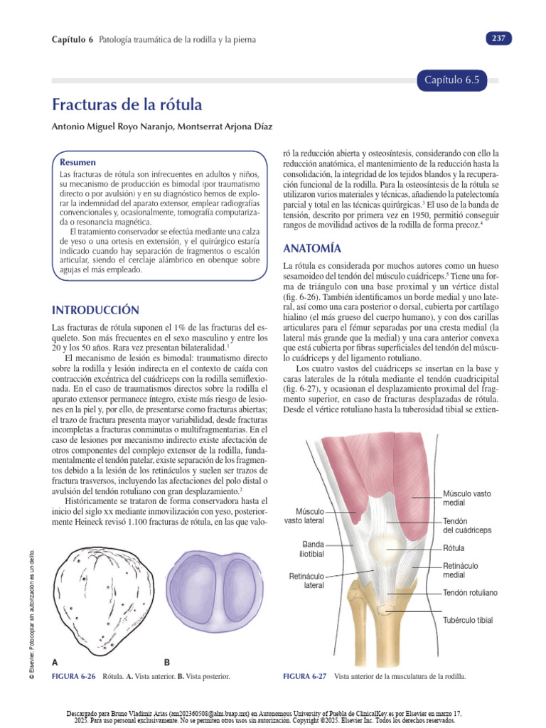 Fracturas de Rótula: Diagnóstico y Tratamiento | PDF | Rodilla ...
