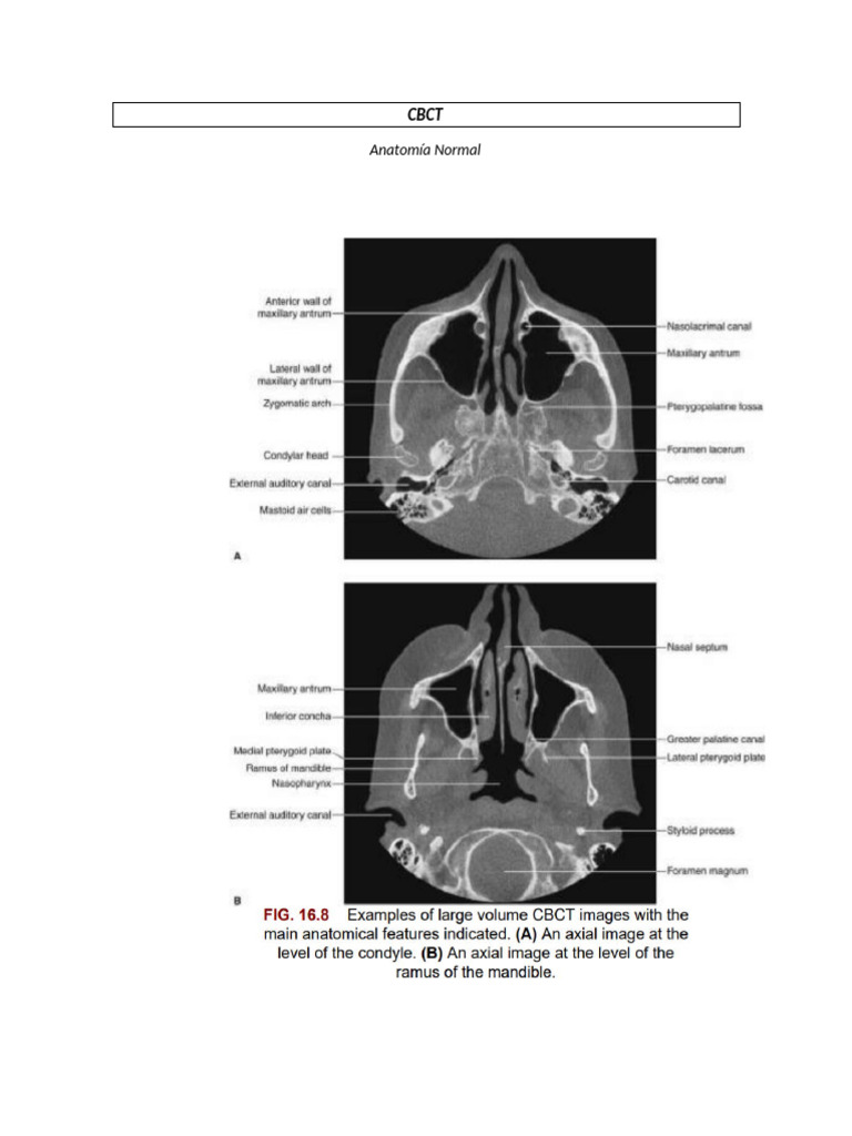 Aplicaciones y Proceso del CBCT en Odontología | PDF