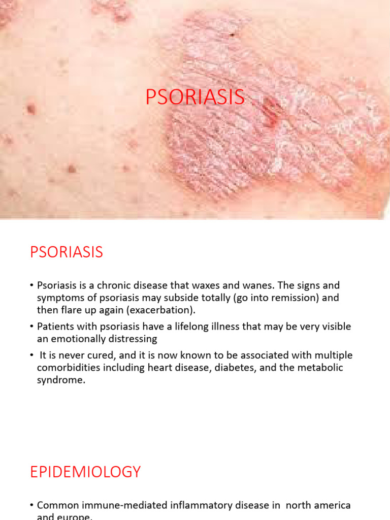 Psoriasis Note 2 | PDF | Psoriasis | Medicine