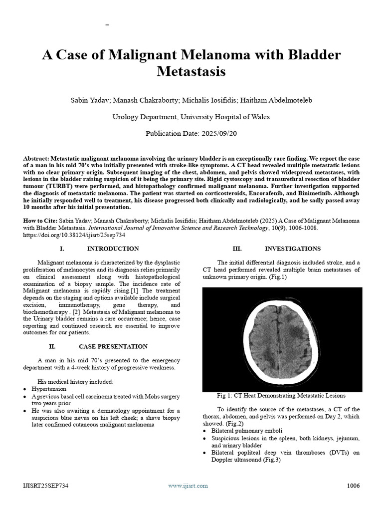 Bladder Metastasis in Malignant Melanoma | PDF | Metastasis | Melanoma
