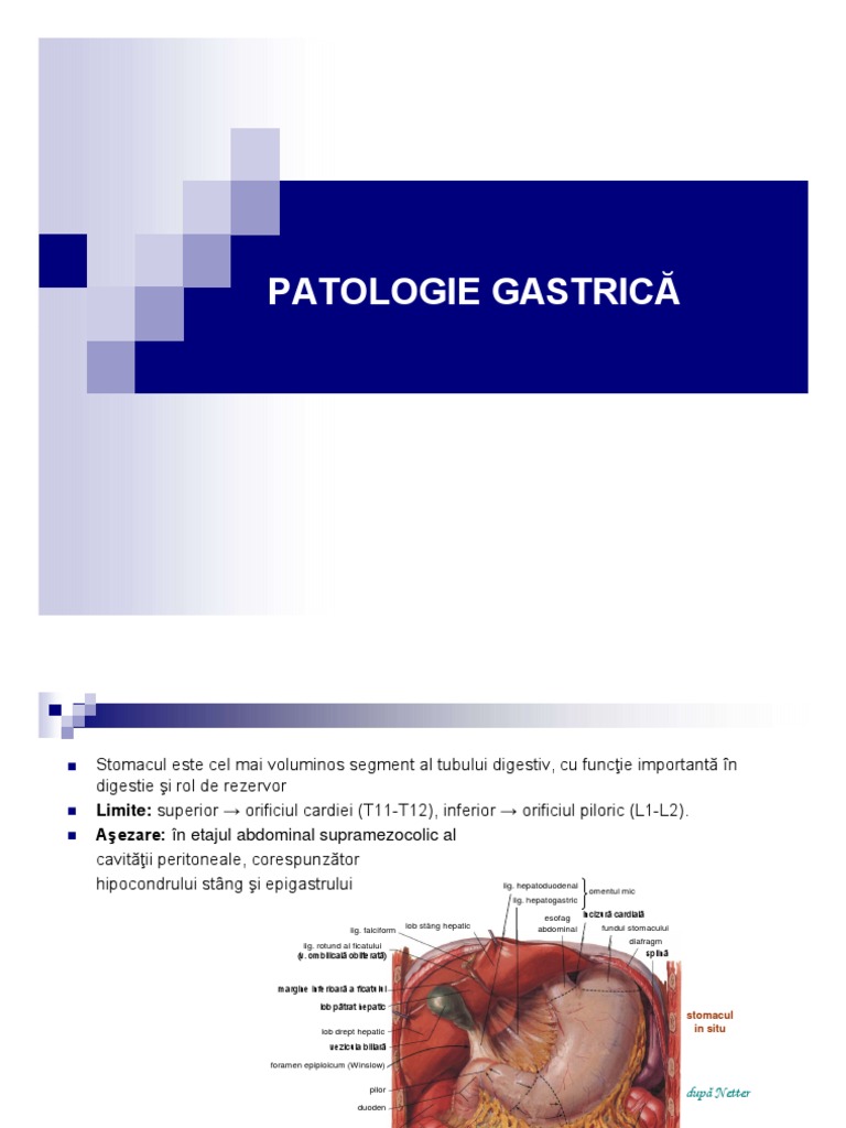 Ulcerul Gastric 2 | PDF