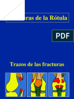 04- Fracturas de La Rotula