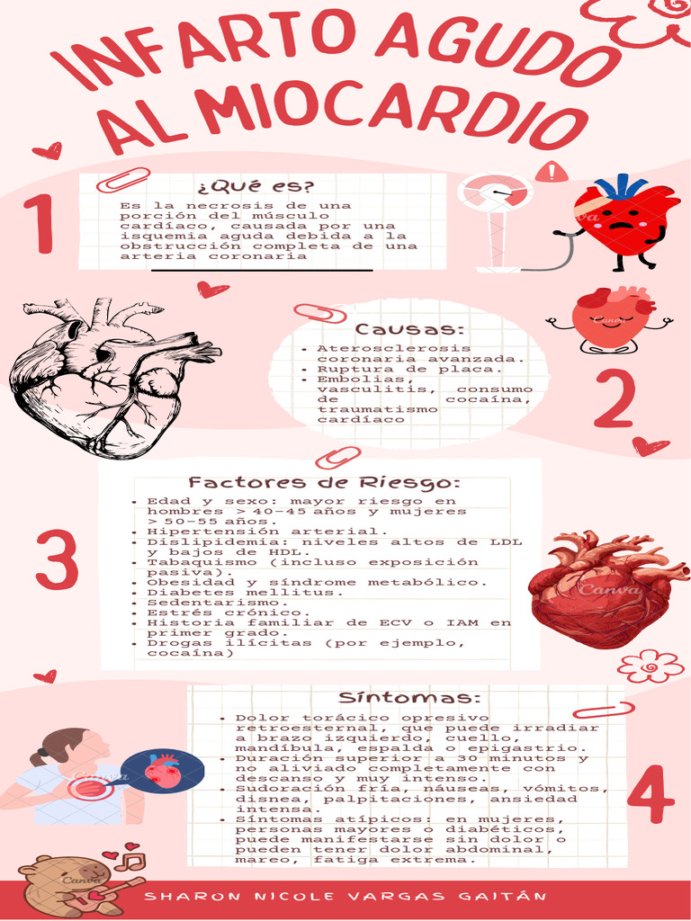 Infarto Agudo de Miocardio: Causas y Síntomas | PDF