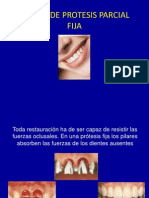 Diseodeprotesisparcialfija 100330095049 Phpapp02