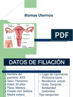 Miomas Uterinos Ok