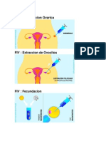 FIV: Estimulacion Ovarica