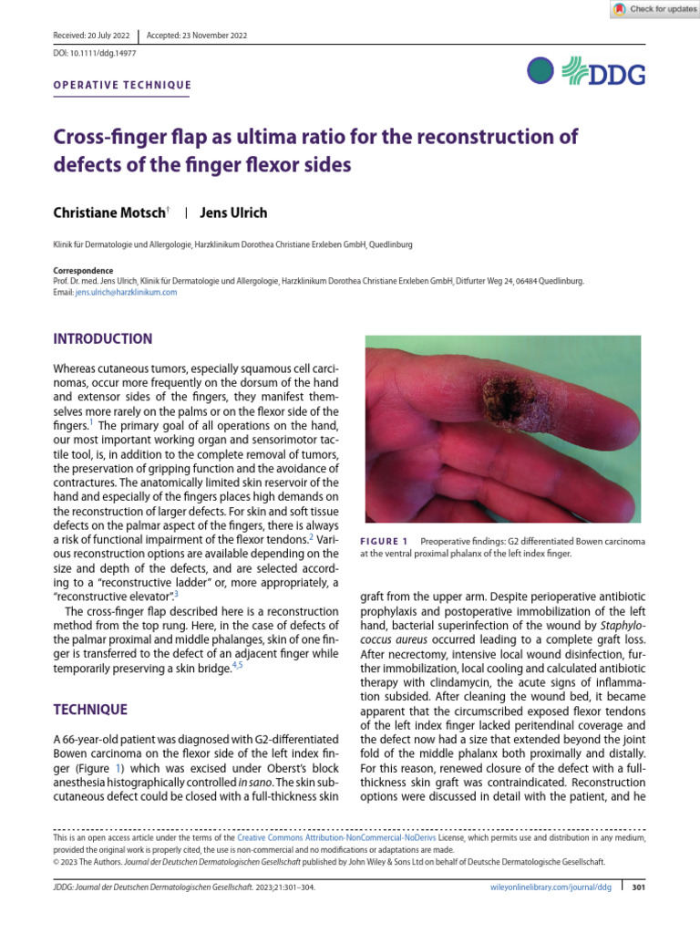 Cross-Finger Flap for Finger Reconstruction | PDF | Hand | Finger