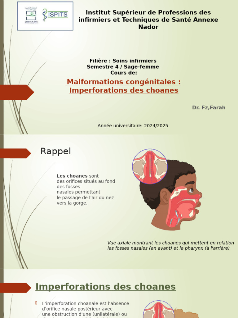 Imperforation des Choanes chez le Nouveau-né | PDF | Endoscopie ...