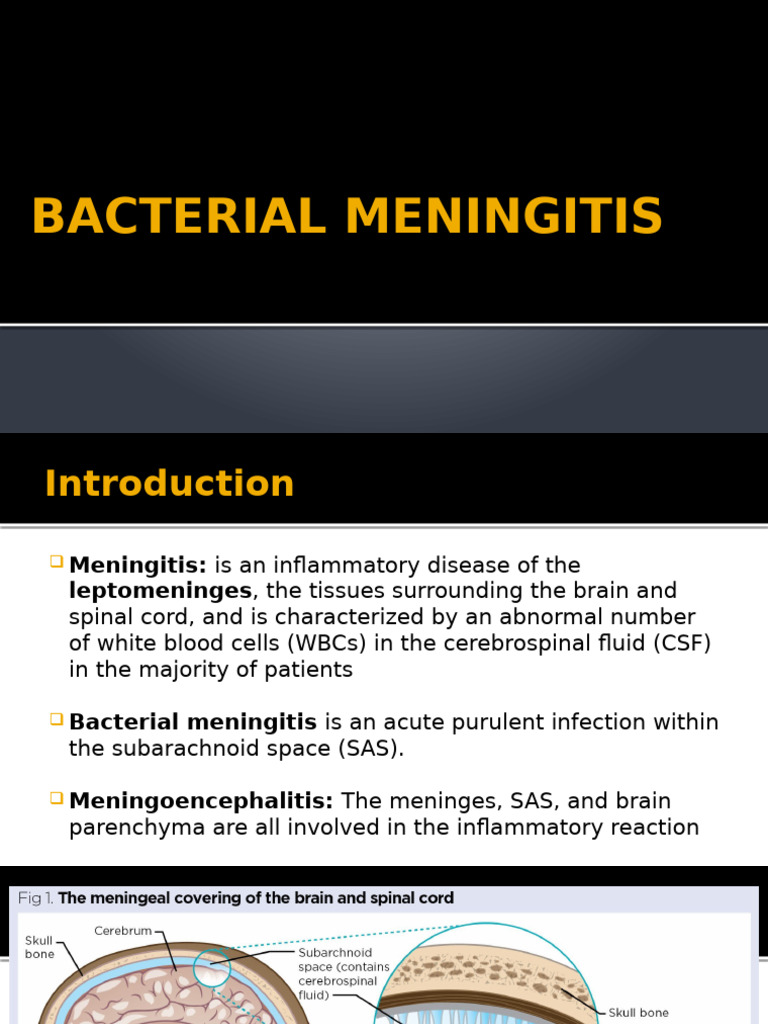 Sources of Bacterial Meningitis | PDF | Meningitis | Human Diseases And ...