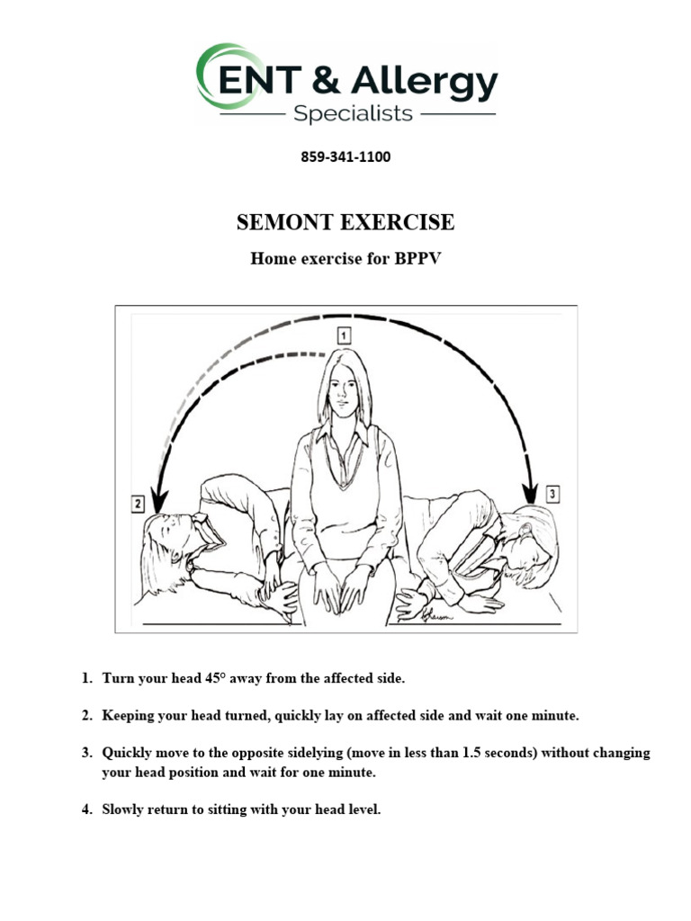 Semont Maneuver for BPPV Relief | PDF