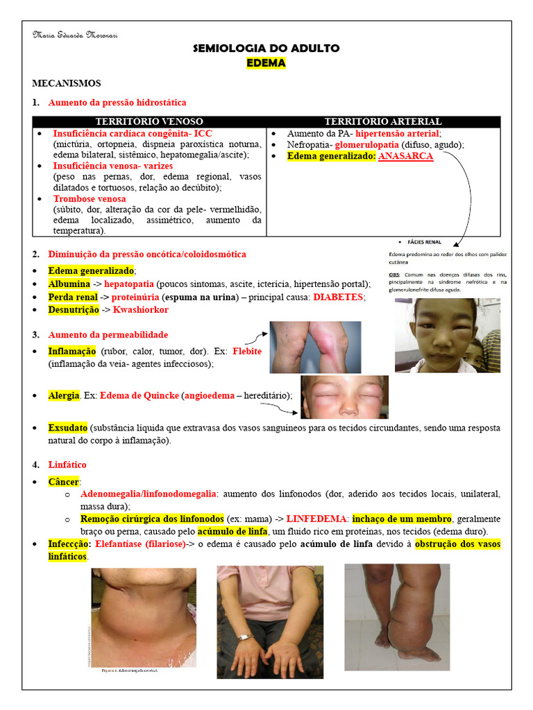 Mecanismos e Classificação do Edema | PDF | Edema | Medicina Clínica