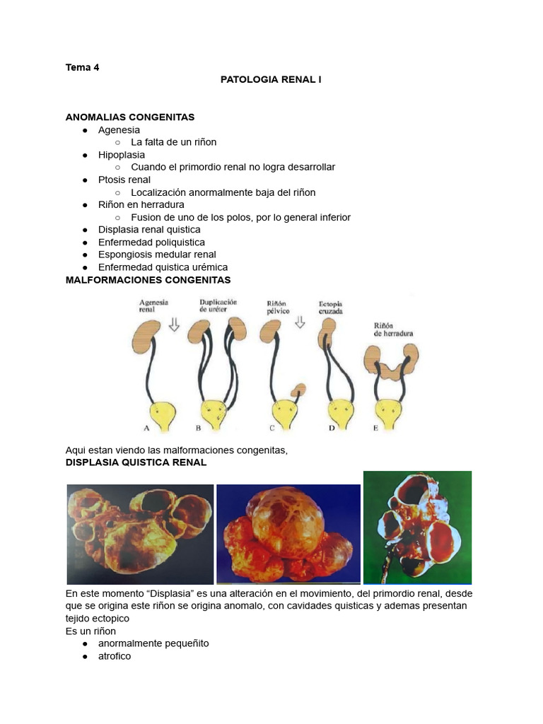 Tema 4 | PDF | Riñón | Edema
