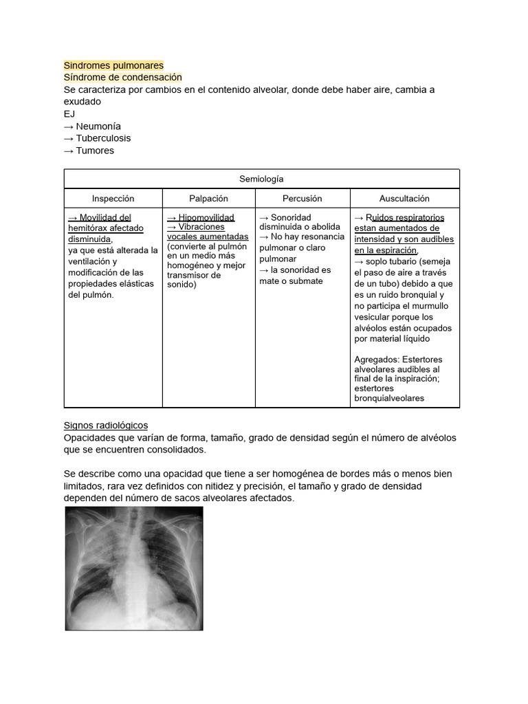 Síndromes Pulmonares: Diagnóstico y Signos | PDF | Pulmón | Sistema ...