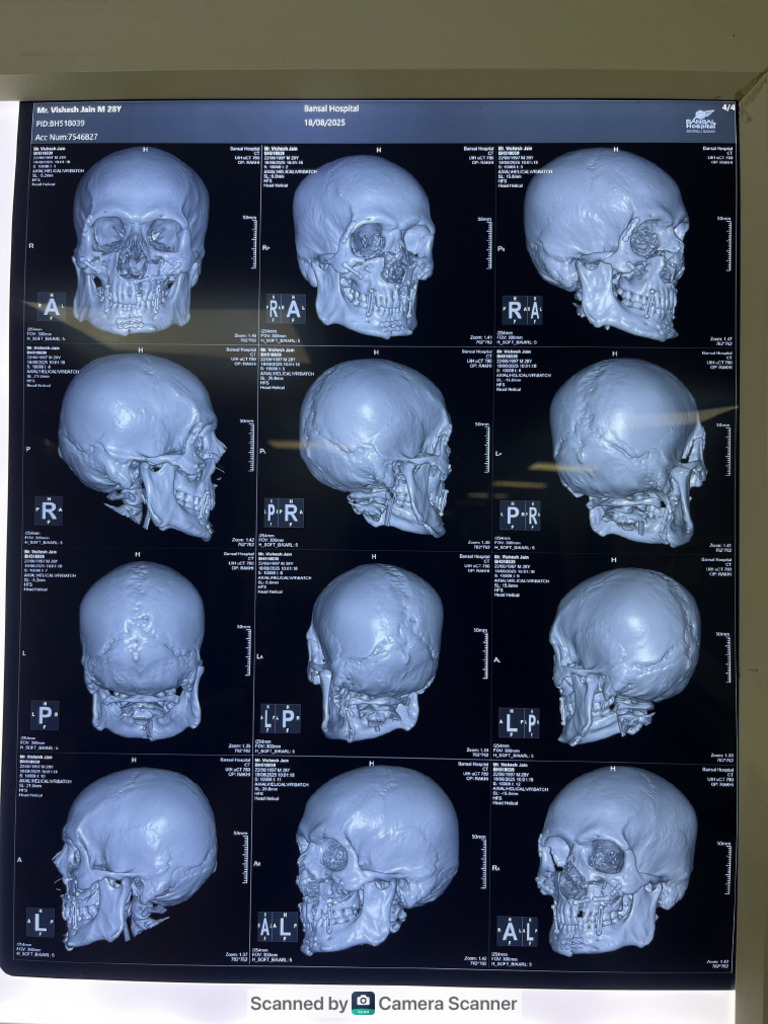 CT Scan Understanding | PDF