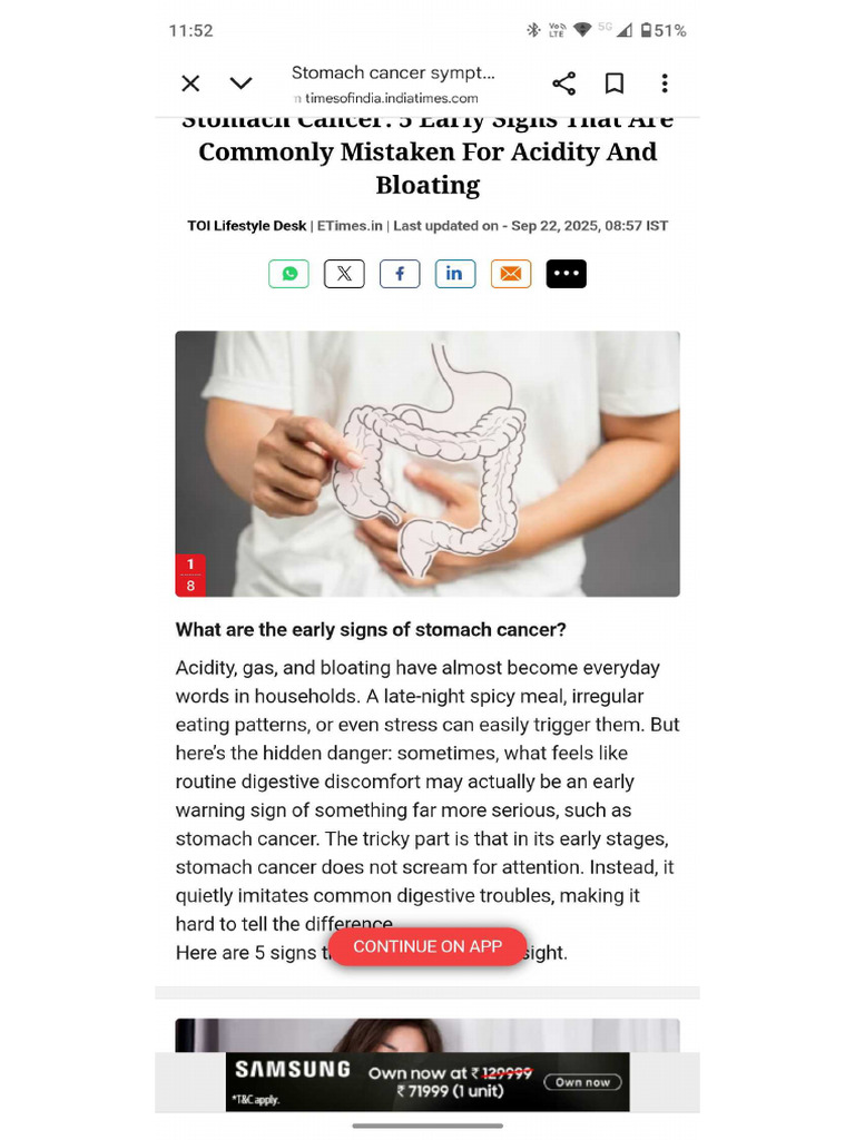 Stomach Cancer Sign | PDF