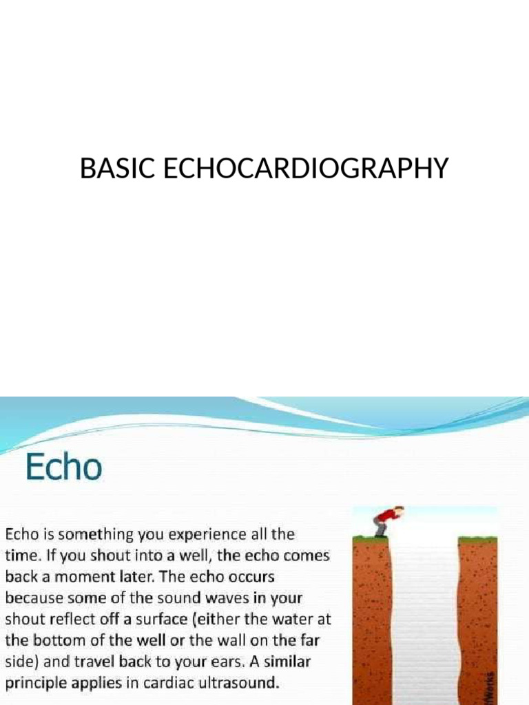 Echo 1 | PDF