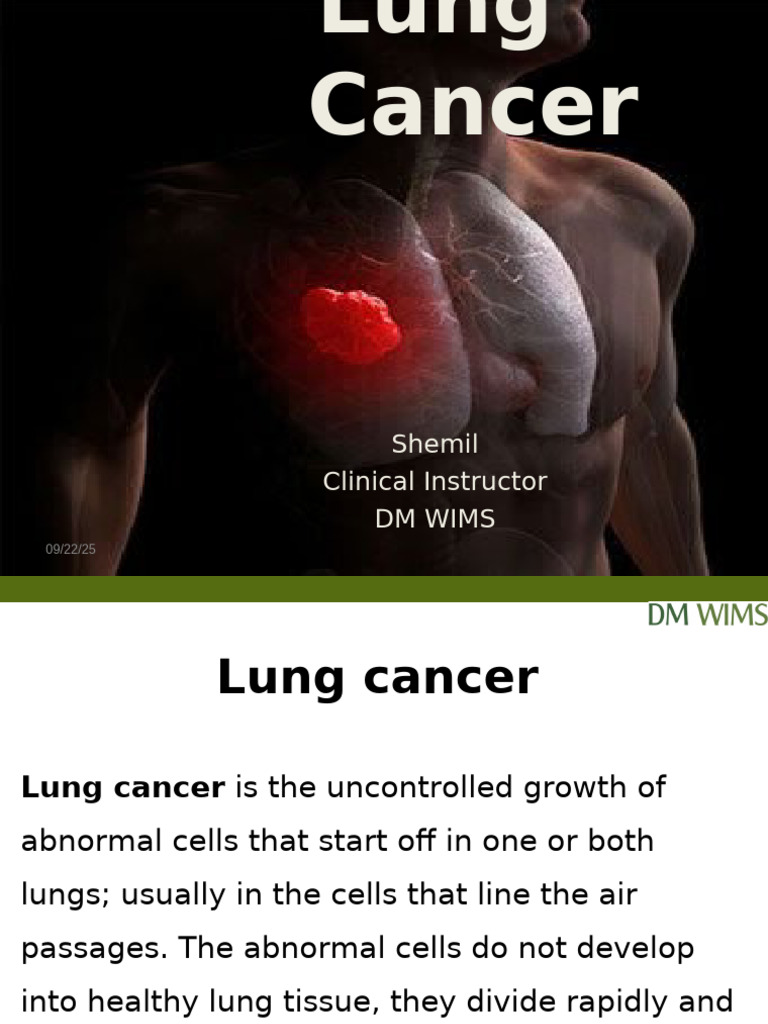 Lungcancer 180519073743 | PDF | Lung Cancer | Metastasis