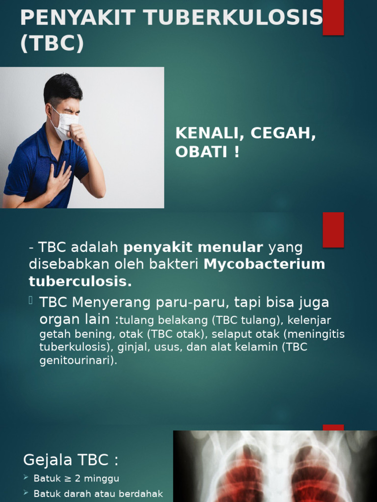PENYAKIT TUBERKULOSIS (TBC) - 1 | PDF