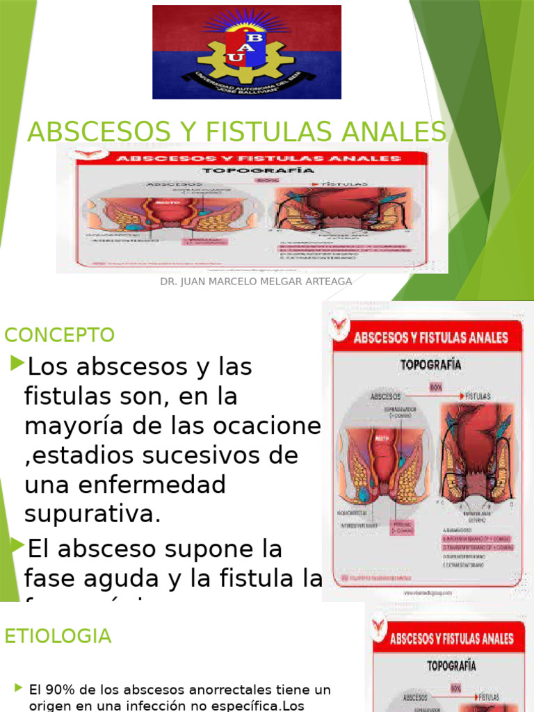 Abscesos y Fístulas Anales: Guía Completa | PDF | Estreñimiento | Heces