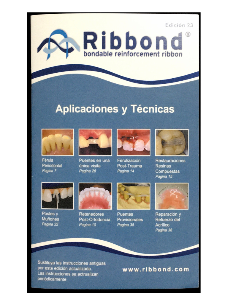 Ribbond | PDF