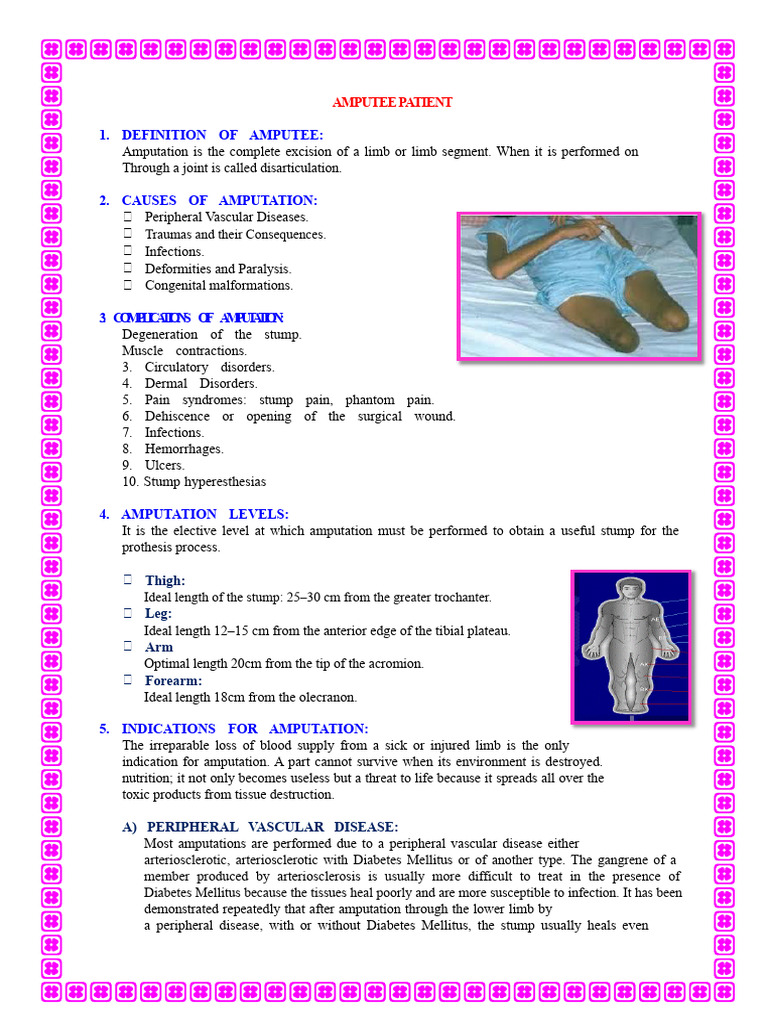 Understanding Amputation and Its Impacts | PDF | Amputation | Pain