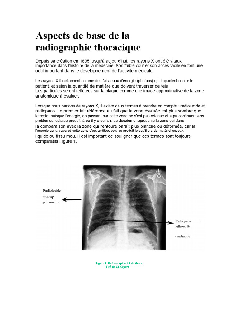Guide sur la radiographie thoracique | PDF | Radiographie | Poumon