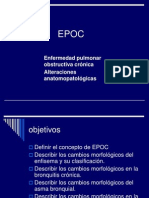 EPOC