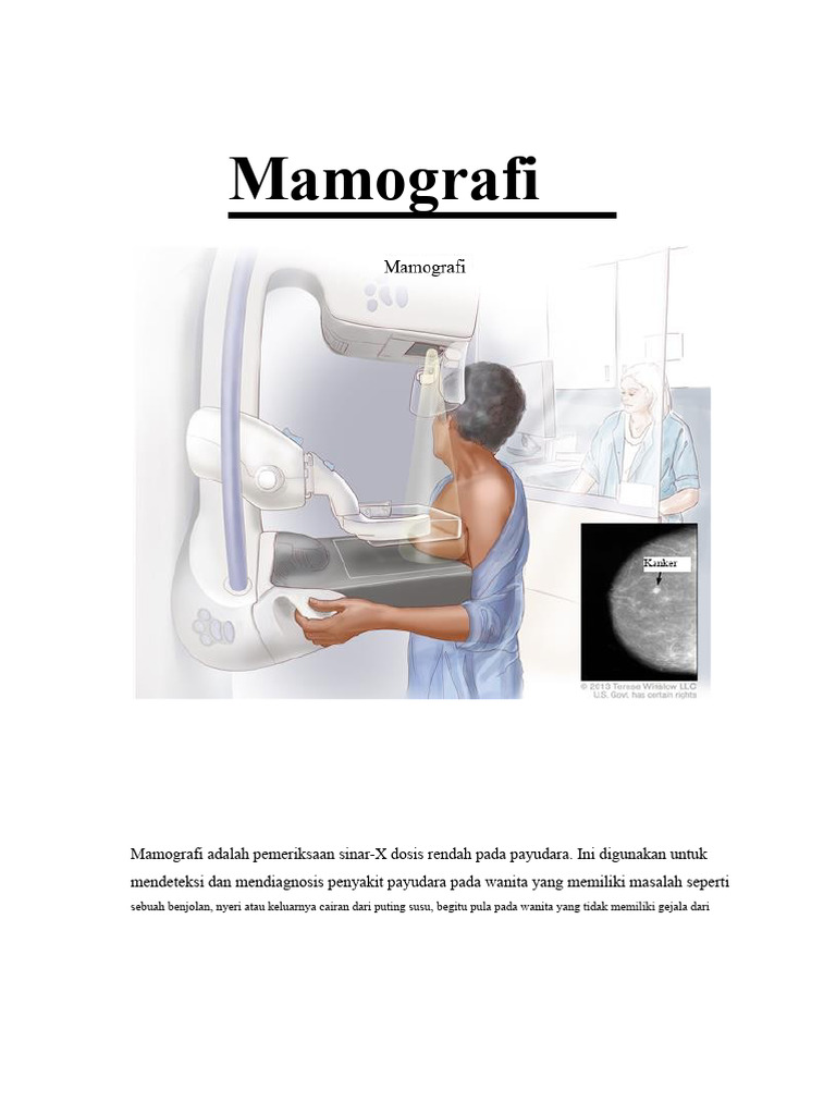 Panduan Lengkap Mamografi untuk Wanita | PDF