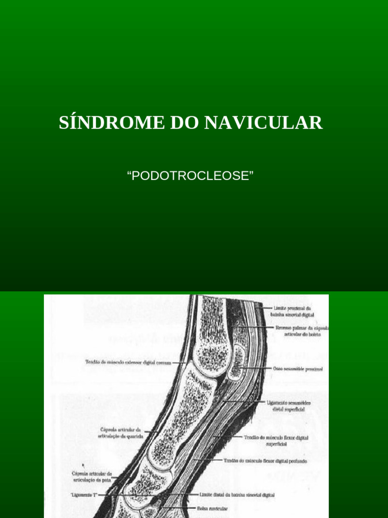 Navicular (3) | PDF | Doenças e distúrbios | Especialidades médicas
