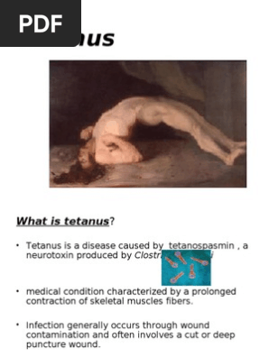 tetanus spatula vaccines