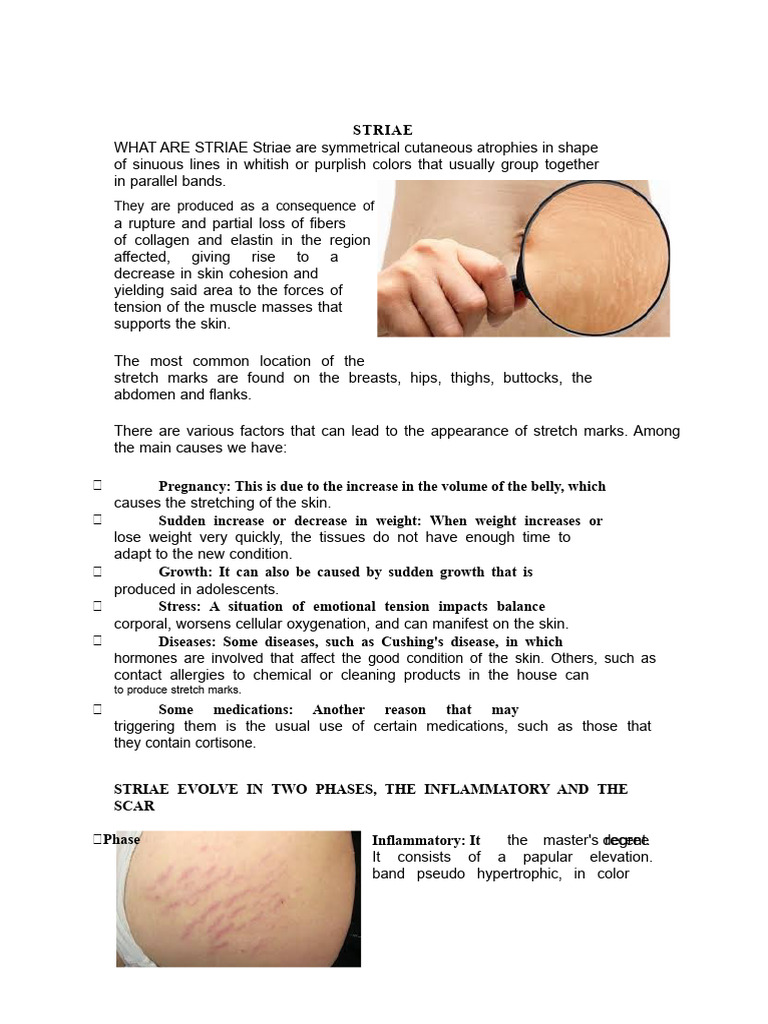 Stretch Marks | PDF | Medical Specialties